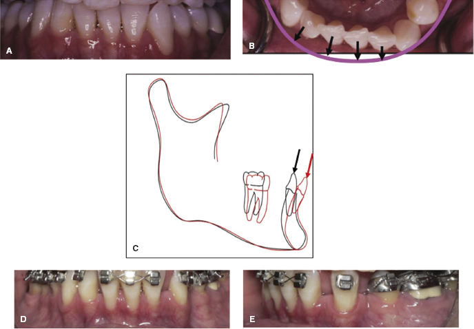 c14-fig-0006