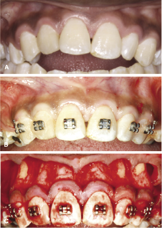 c14-fig-0007