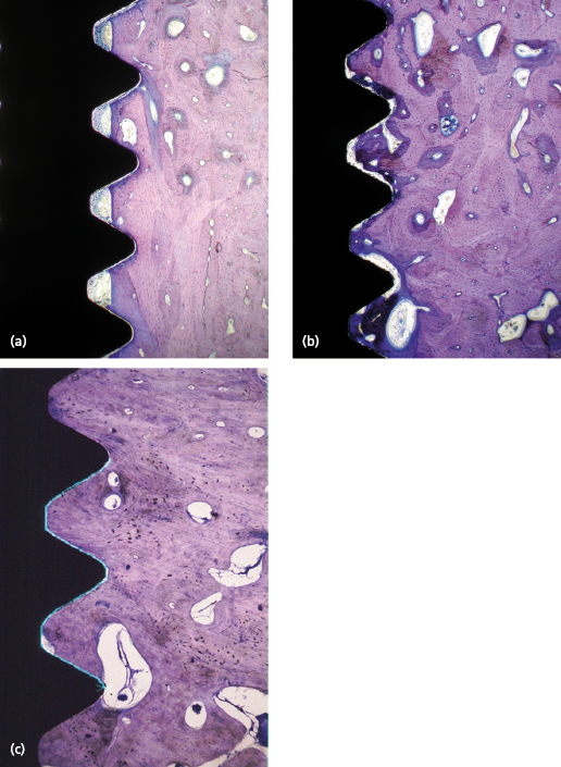 c14-fig-0008