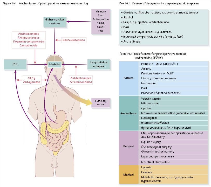 14 Postoperative Nausea And Vomiting Pocket Dentistry