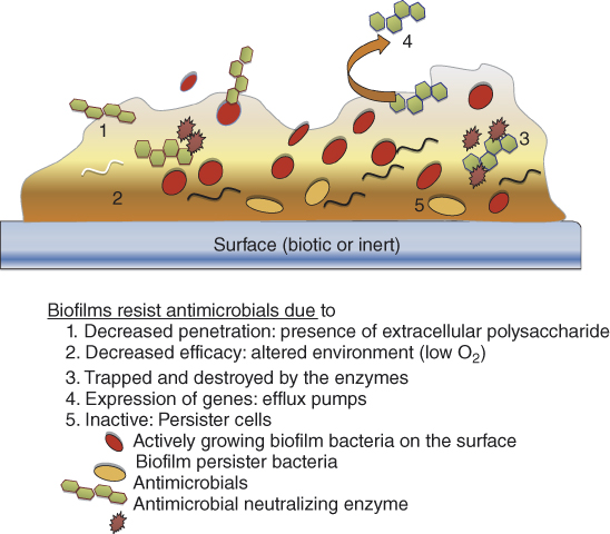 Root Canal Disinfection Using Highly Effective Aggregation-Induced