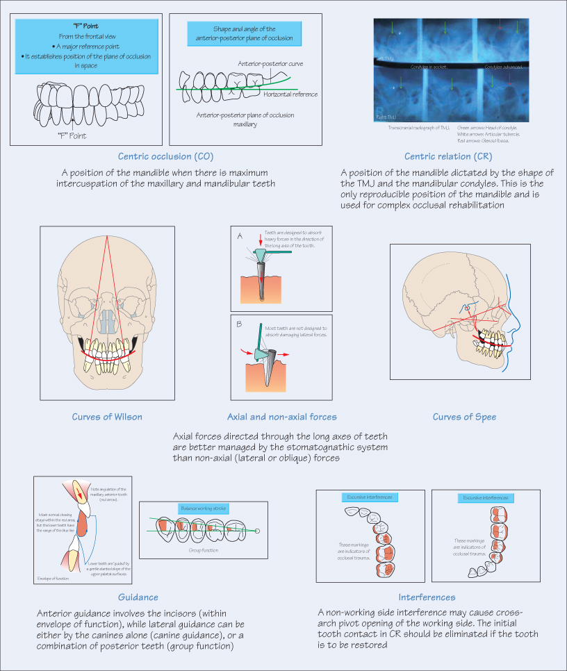 14-occlusion-terminology-and-definitions-pocket-dentistry