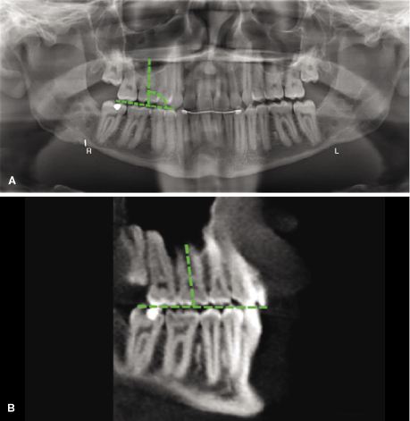 c15-fig-0002