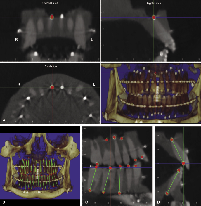 c15-fig-0003