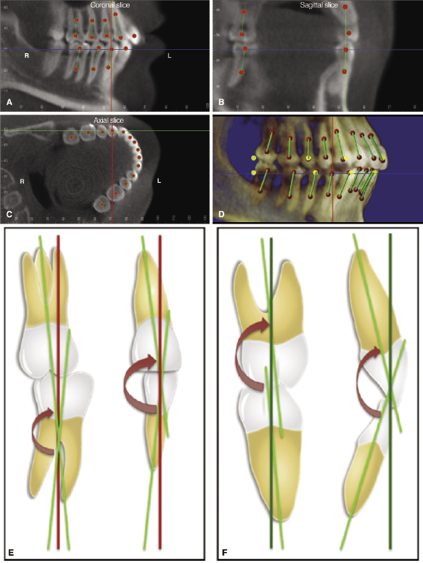 c15-fig-0004