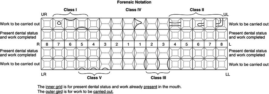 Dental Notation Chart