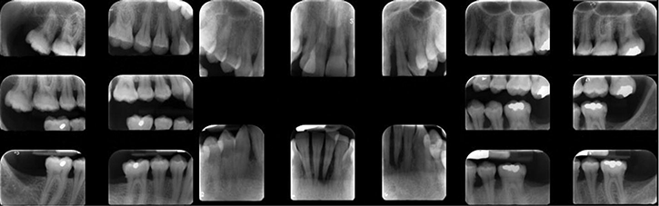 c15-fig-0006