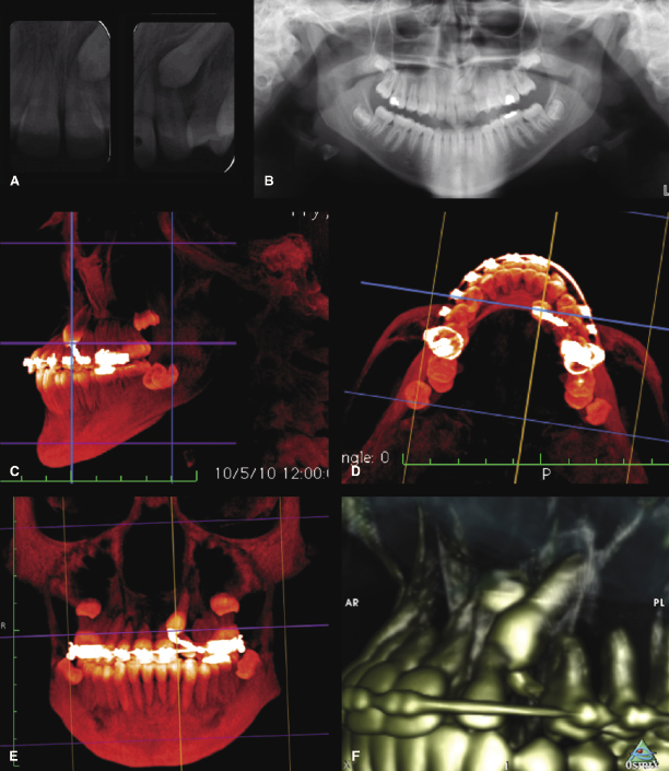 c16-fig-0001