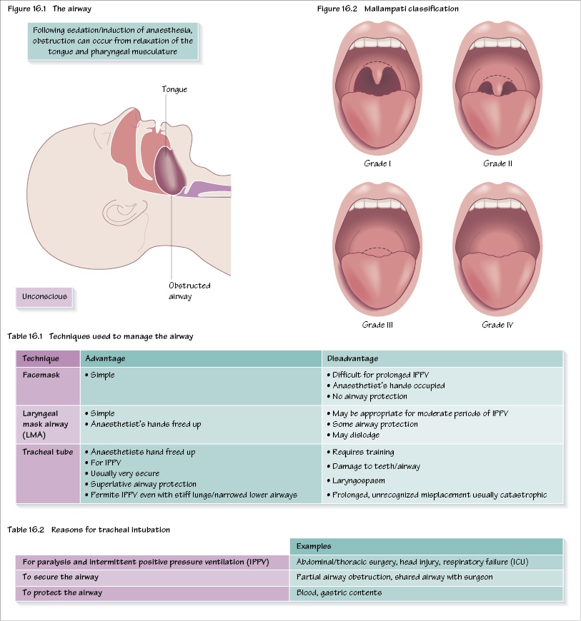 Upper Airway Obstruction Caused By Lowgrade Tracheal