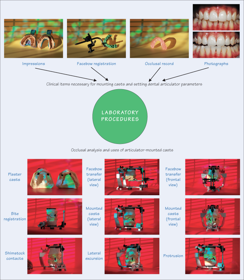 16 Occlusion: laboratory procedures | Pocket Dentistry