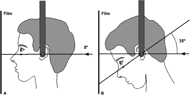 c17-fig-0003