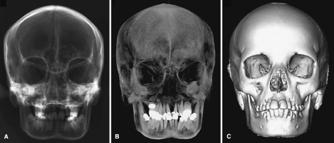 c17-fig-0004