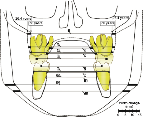 c17-fig-0005