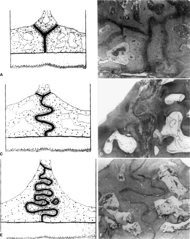 c17-fig-0006