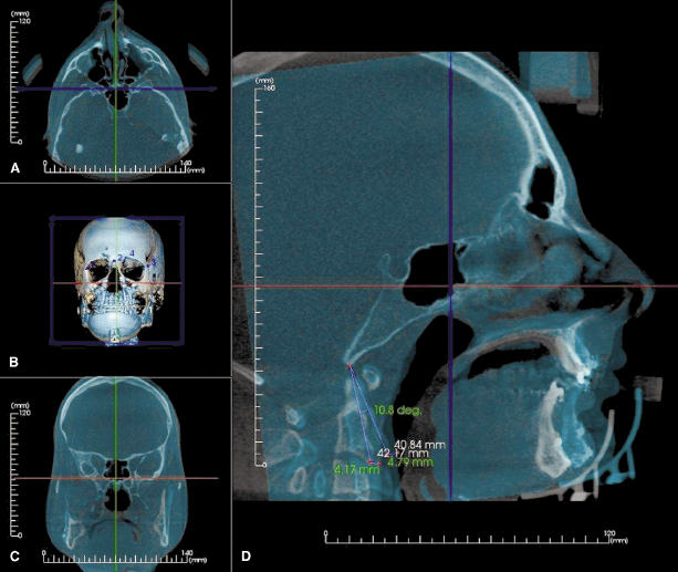 c20-fig-0005