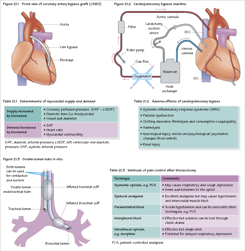 c21-fig-5001