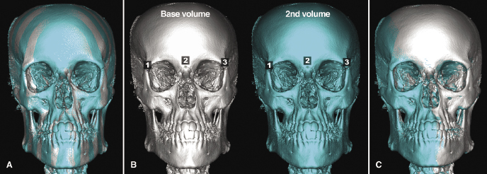 c22-fig-0001