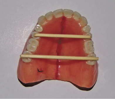 dental repair fx