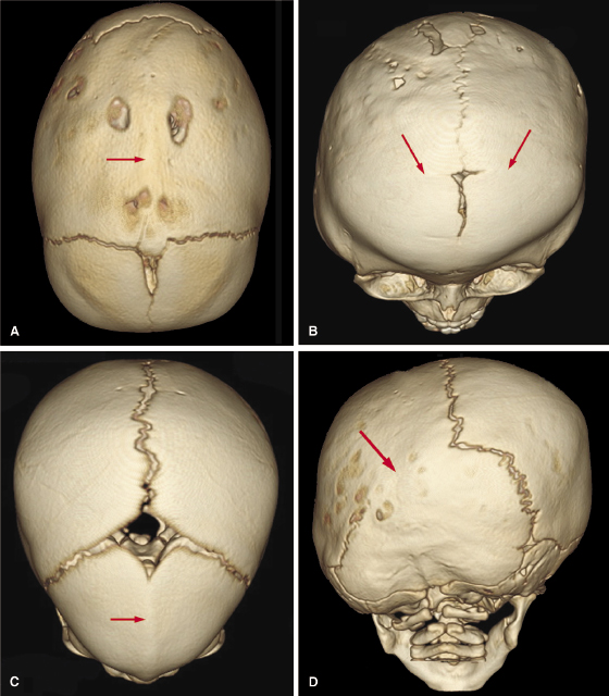 c23-fig-0002