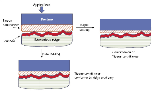 c23-fig-0004