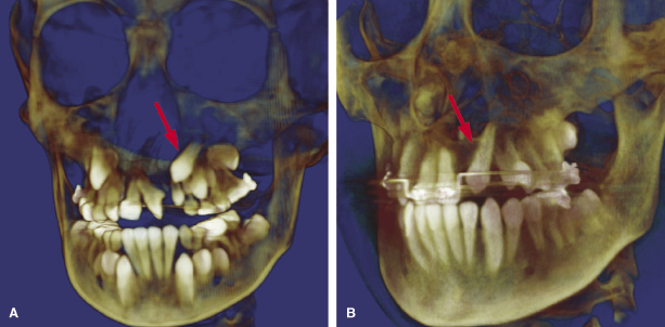 c23-fig-0005