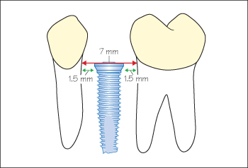 c23f001