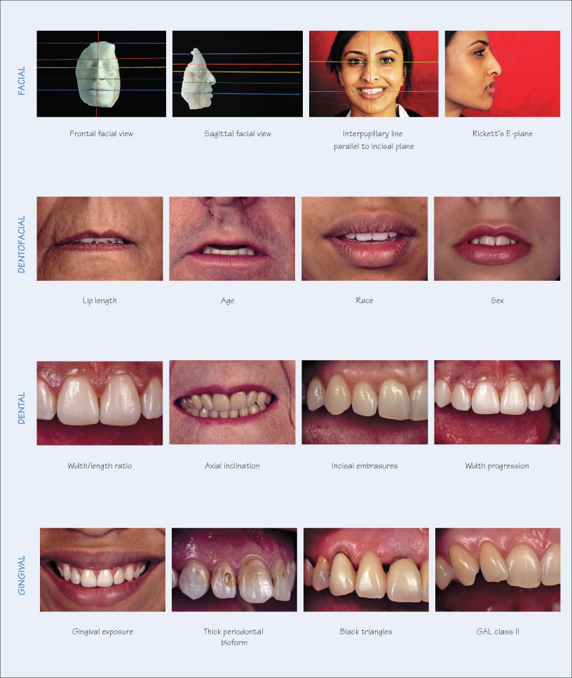 23 Anterior Dental Aesthetics Basic Principles Pocket Dentistry 