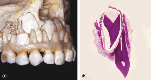 c26-fig-0005