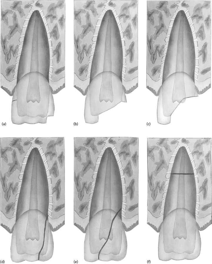 c26-fig-0013