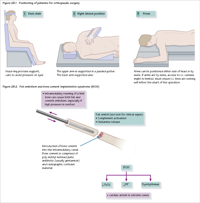 c26-fig-5001