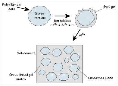 gic glass ionomer cements