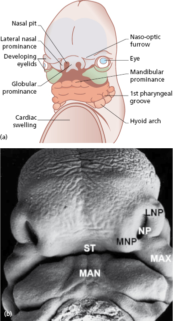 c29-fig-0001