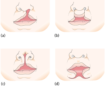 c29-fig-0002