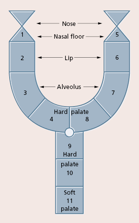 Cleft Lip And Palate Chart