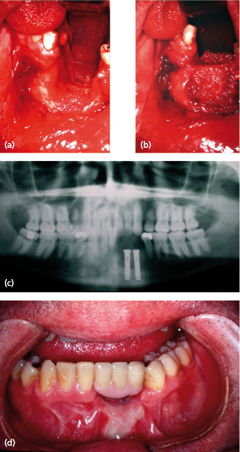 c31-fig-0001