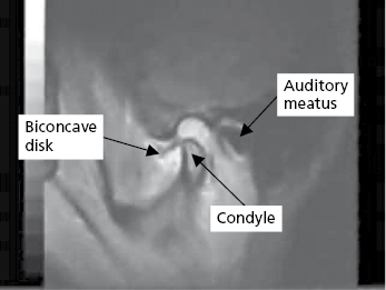 c32-fig-0002