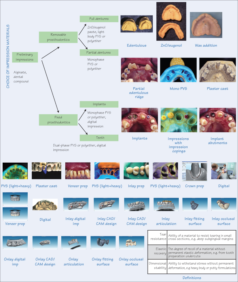 Non Elastic Impression Materials, Dental Materials