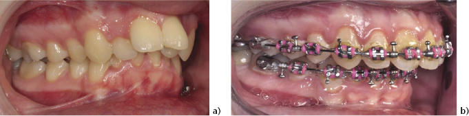 c4-fig-0002