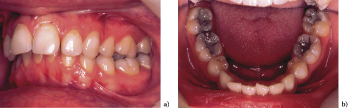 c4-fig-0003