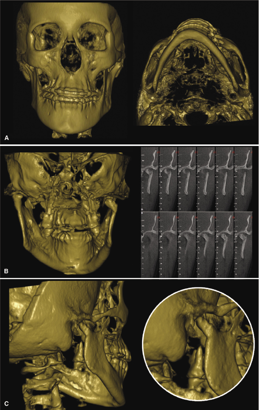 c4-fig-0004