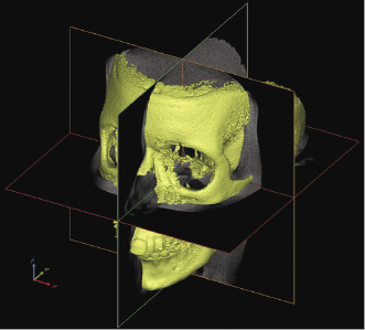 c4-fig-0005