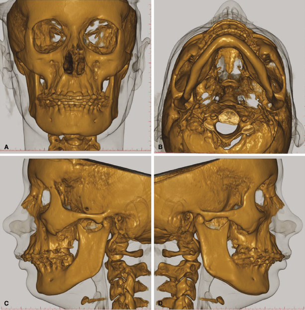 c4-fig-0006