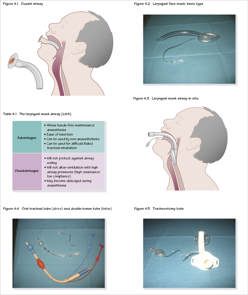 laryngeal mask airway vs endotracheal tube
