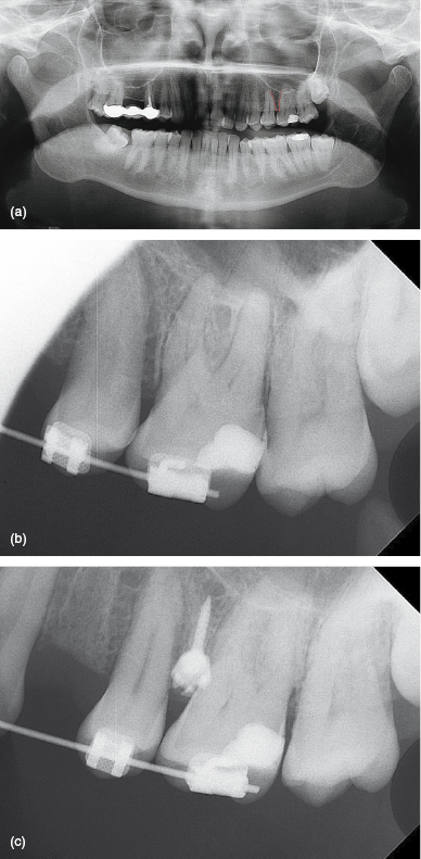 c5-fig-0001