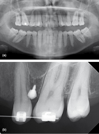 c5-fig-0004