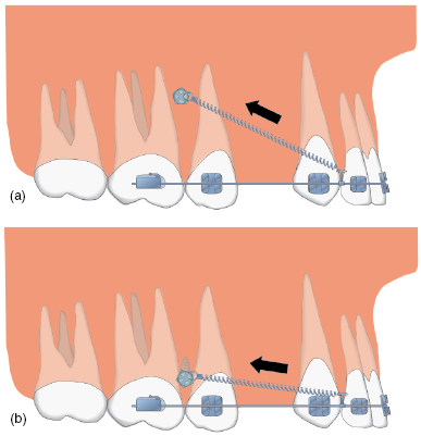 c5-fig-0006