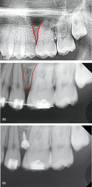 c5-fig-0007