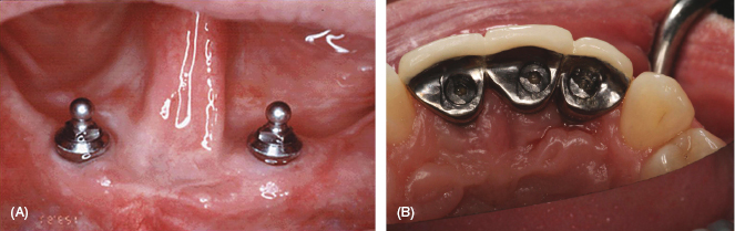 c6-fig-0003