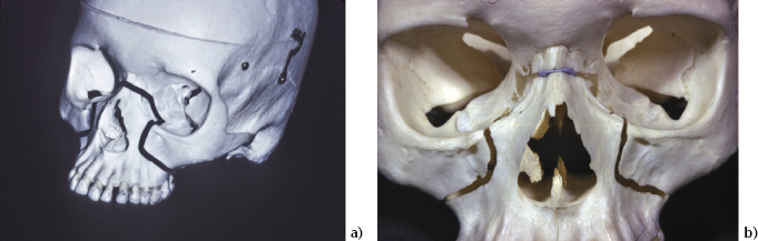 c8-fig-0001