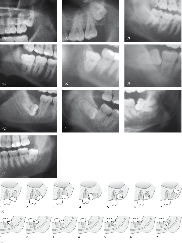 c9-fig-0004